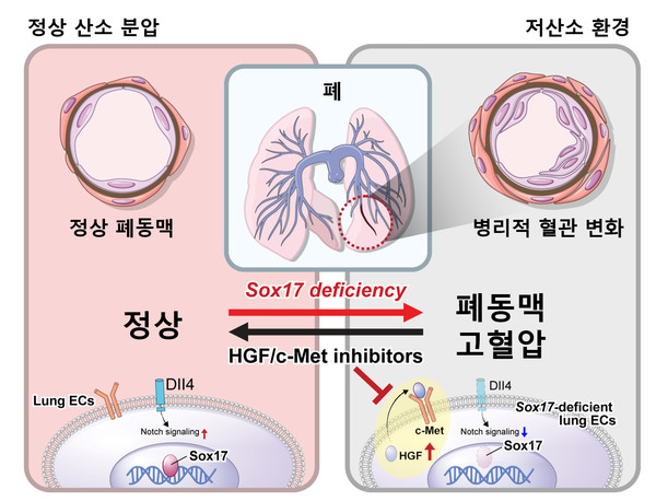 Sox17 유전자가 결핍되고 저산소 환경에 노출되면 폐동맥 고혈압의 발생 위험이 높다