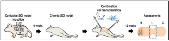 만성 중증 척수손상 모델에 유도만능줄기세포 유래 운동신경전구세포(iMNP) 및 뇌유래신경영양인자가 과발현되게 설계된 MSC(BDNF-eMSC)를 조합세포 동시 이식하는 모식도
