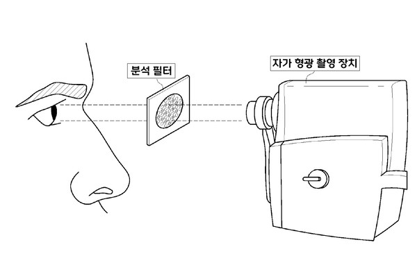 분석 필터를 활용해 자가 형광 신호를 촬영함으로써 수정체 이상 여부를 객관적으로 평가할 수 있다