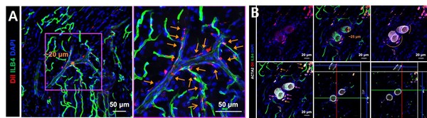 A.조직 내 세포 추적을 통해 rSMC(red)가 혈관(green)벽 안으로 정착하는 능력 확인해 rSMCs가 단순히 모양만 비슷한 것이 아니라, 실제로 혈관 벽에서 평활근세포로서 역할을 수행할 수 있는 것을 확인했다. B. 조직 내 세포 추적을 통해 rSMC(red)가 세동맥의 혈관 벽(white)안으로 정착하는 능력을 확인했다.
