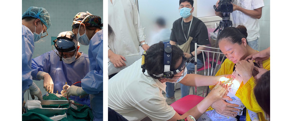 [부산대치과병원] 황대석·류지혜 교수, 베트남 구순구개열 환아 수술 봉사