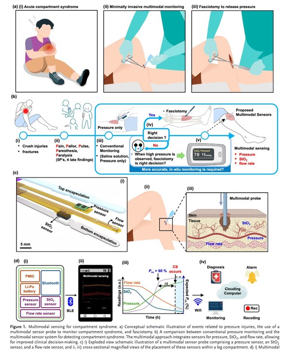 사진은 연구 모식도로 a) 구획 증후군과 압력 부상 발생에 따른 치료 흐름의 도식화 그림, b) 압력 해소를 위해 근막절개술을 시행하는 다중 모드 감지 프로브의 사용을 나타내는 그림, c) 구획 증후군 감지를 위한 멀티 모달 센서 프로그램과 기존의 구획압 측정 모니터링 시스템 비교 그림, d) 압력과 조직 산소 포화도, 혈류량 센서로 구성된 멀티모달 감지 프로브의 확대 도식도와 센서를 다리 구획 내에 배치한 단면도, e) 구획 증후군 감지를 위한 멀티모달 센서 시스템의 도식도.