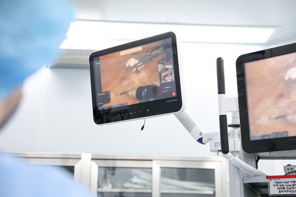 [안산병원] 장영우 교수, 겨드랑이로 갑상선암 수술 ‘GOSTA’ 라이브 서저리