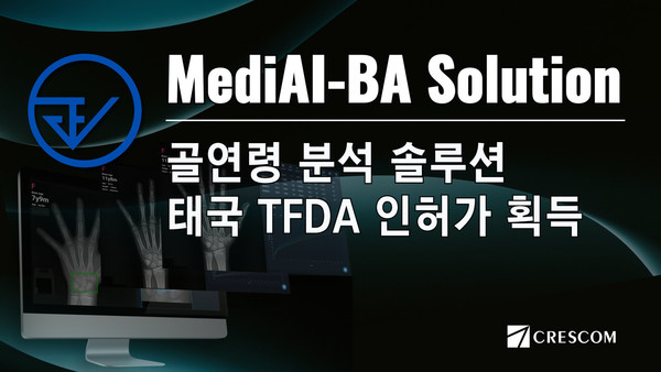 크레스콤, 골연령 분석 솔루션 MediAI-BA 태국 TFDA 의료기기 인허가 획득