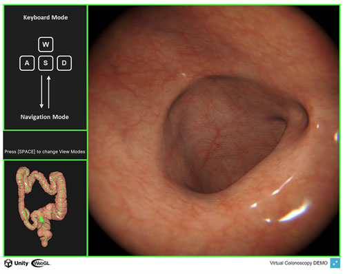 AI 이용해 실제 대장내시경 환경 재현한 가상 시뮬레이터 ‘SeamXSim’ 개발